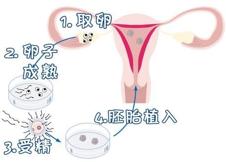医院环境